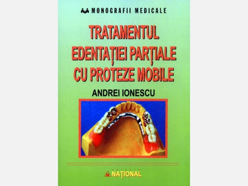 Tratamentul-edentatiei-partiale-cu-proteze-mobile.jpg